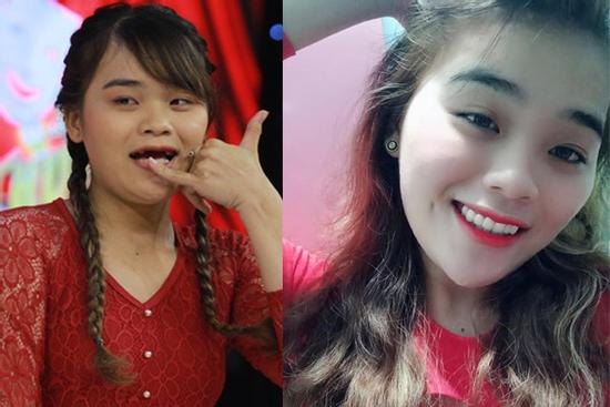 Ẵm trọn 100 triệu ở Thách Thức Danh Hài, dân mạng 'khai quật' loạt ảnh thời chưa làm răng của 'thánh sún'