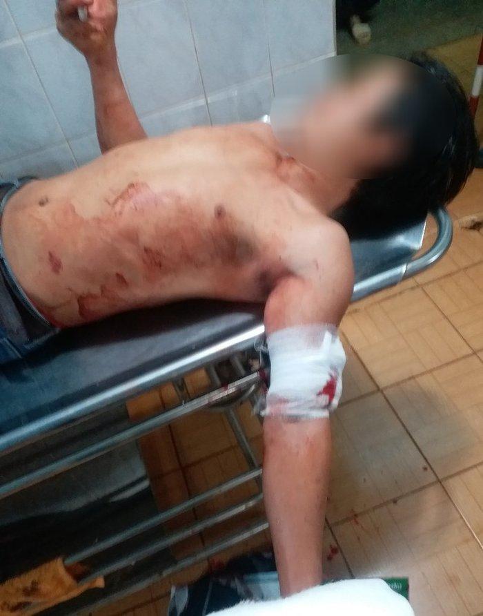 Vác rựa truy sát hàng xóm vì mở nhạc quá to-1