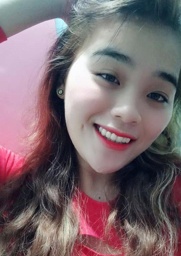 Hé lộ hình ảnh mới nhất được cho là của thánh sún Thách Thức Danh Hài sau khi làm răng-2