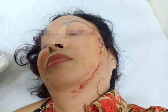 Nghi án người phụ nữ bị chồng cũ bạo hành, doạ giết cả gia đình trong suốt nhiều năm