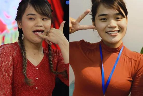 Dân mạng rần rần khen ngợi hàm răng mới siêu xịn của 'thánh sún' Thách Thức Danh Hài sau khi được 'trùng tu'