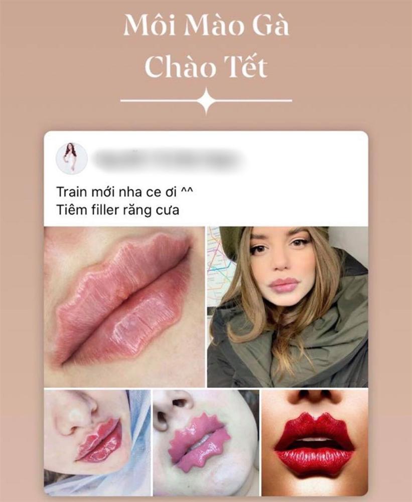 Môi Mazda hết thời, dân mạng lại xôn xao vì kiểu môi răng cưa, môi mào gà đón Tết-1