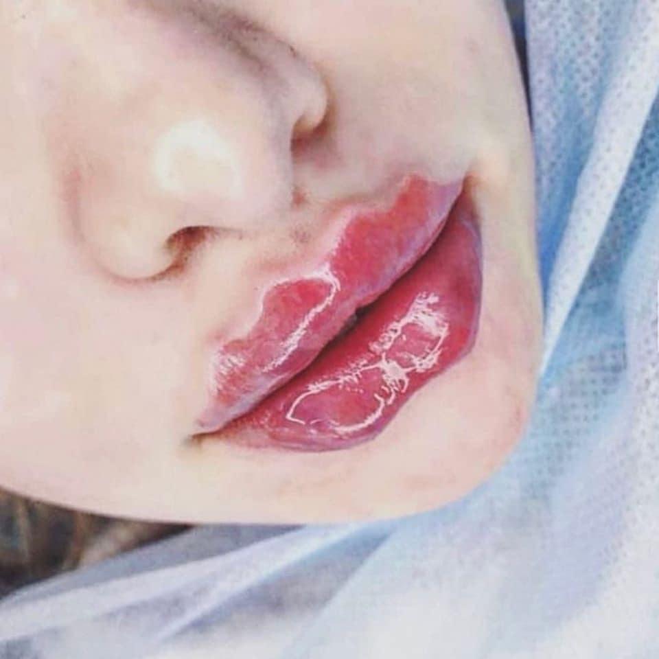 Môi Mazda hết thời, dân mạng lại xôn xao vì kiểu môi răng cưa, môi mào gà đón Tết-2