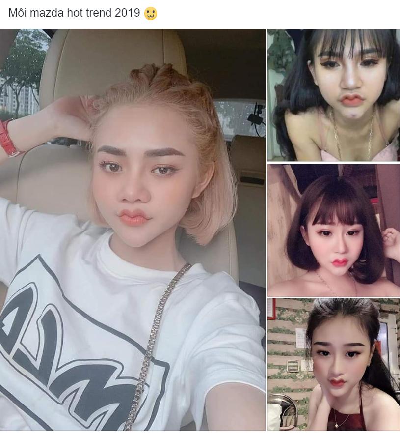 Môi Mazda hết thời, dân mạng lại xôn xao vì kiểu môi răng cưa, môi mào gà đón Tết-13