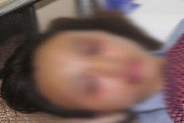 Phẫn nộ: Em bé 4 tháng tuổi ở TP HCM nghi bị bố ruột dạy dỗ đến mức gãy chân, xuất huyết não-6