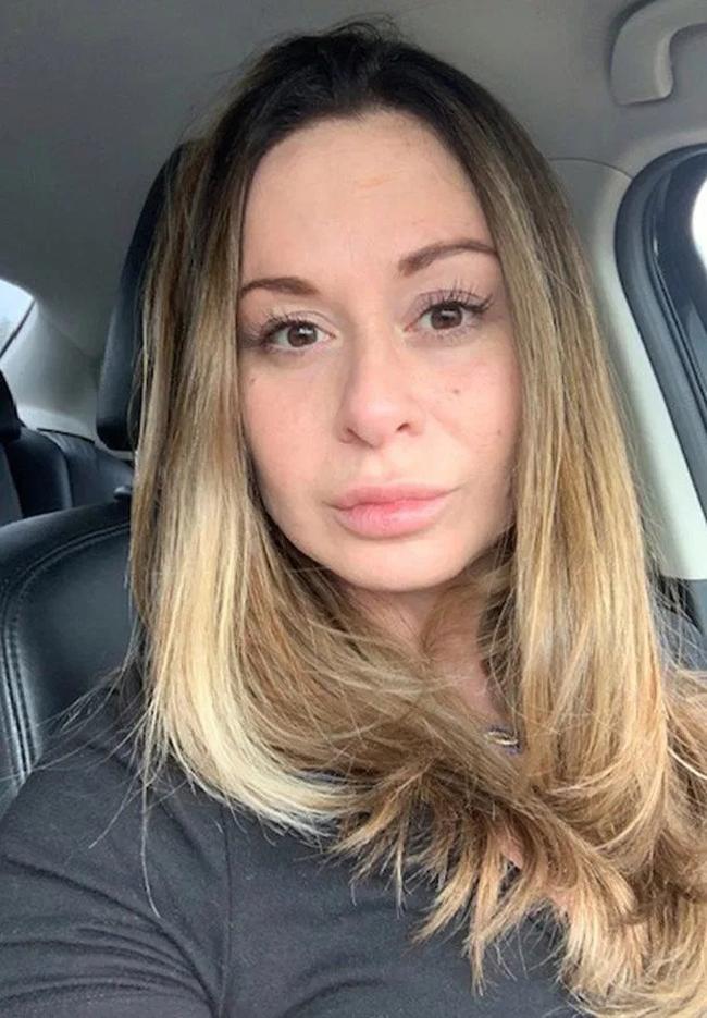 Hoại tử ngực sau khi dao kéo vòng một-1