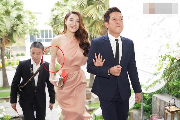 Vừa mới đổi gió sang váy ngắn, Nhã Phương lộ đôi chân da bọc xương đến photoshop cũng không cứu nổi-1