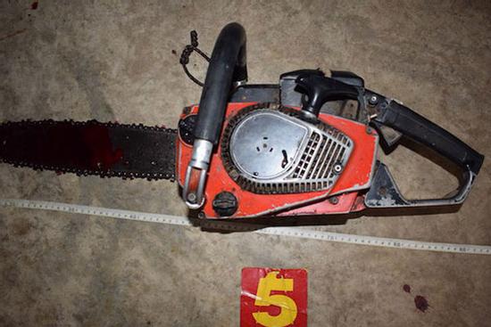 Tự dùng cưa máy cắt cổ