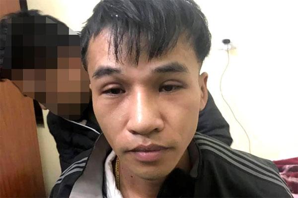 Cô gái xinh đẹp trở thành đứa trẻ thiểu năng sau nâng mũi, cắt mí-3