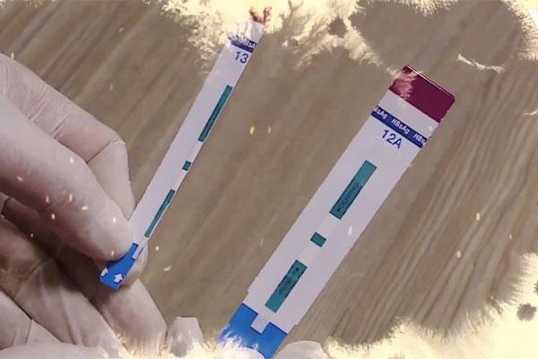 BV Xanh Pôn cắt đôi que thử HIV, viêm gan B: Tạm đình chỉ 3 người-1