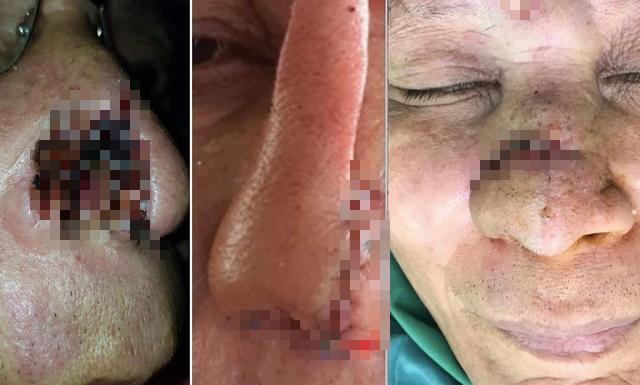 Cần Thơ: Cháu nhậu say cắn mũi bác rồi nuốt luôn vào bụng-1