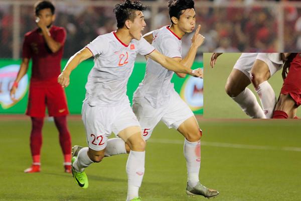 Thầy Park giận tím người với chính đội ngũ bác sĩ của U22 Việt Nam vì lý do đặc biệt-3