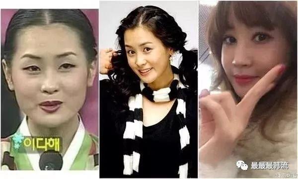 Nữ hoàng dao kéo Lee Da Hae hồi xuân, lấy lại nhan sắc xinh đẹp ngày nào-10