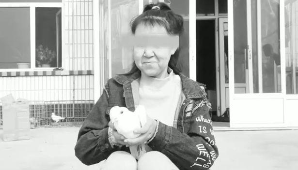 Thiếu nữ 15 tuổi bỏ học vì gương mặt như bà lão 60-2