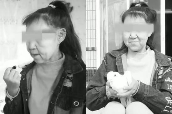 Thiếu nữ 15 tuổi bỏ học vì gương mặt như bà lão 60