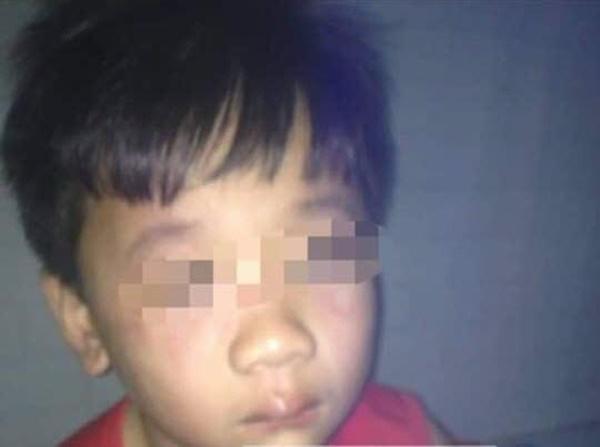 Vụ cha ép con uống rượu: Có thể xử lý hình sự tội hành hạ người khác-1