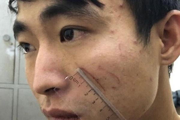 Hé lộ nguyên nhân đối tượng sát hại người yêu trong nhà nghỉ ở Sầm Sơn-1