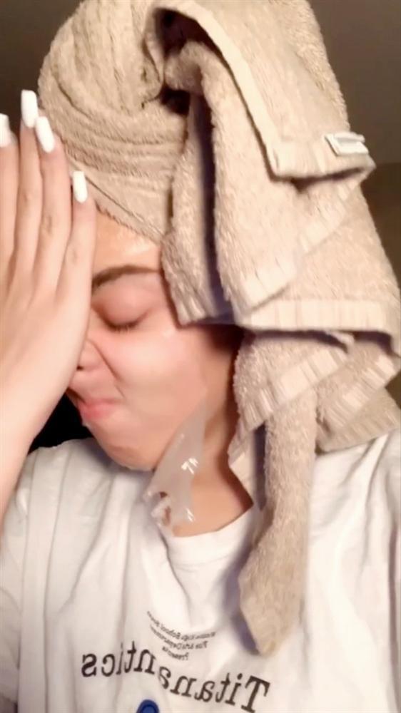 Cô gái mất một tiếng chỉ để lột miếng mặt nạ dính chặt vào da-2