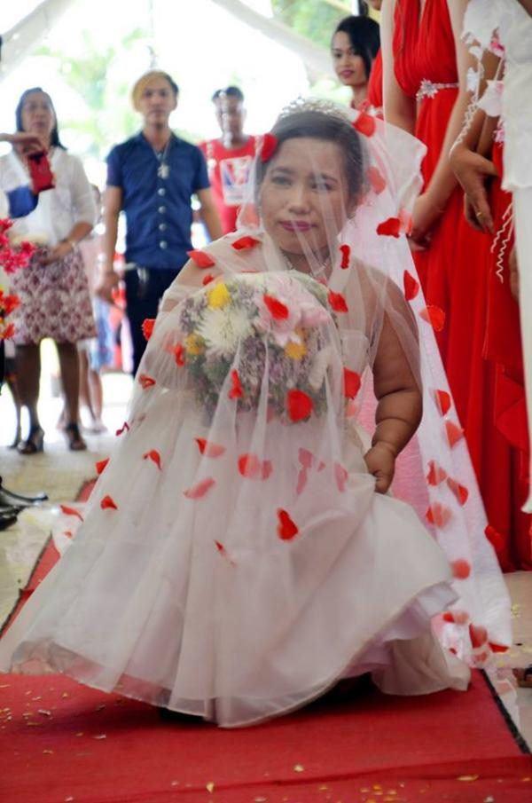 Mắc bệnh ngừng phát triển, cô dâu gây sốt khi tiến vào lễ đường với chú rể cao gấp đôi-3