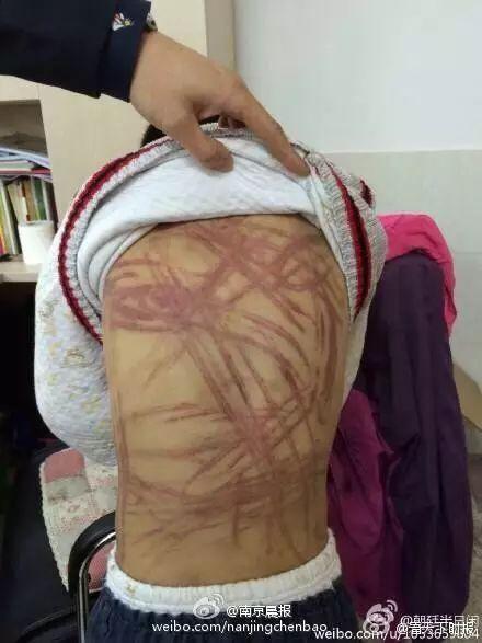 Bé trai bị mẹ bạo hành: Con chỉ còn mỗi mẹ thôi-2