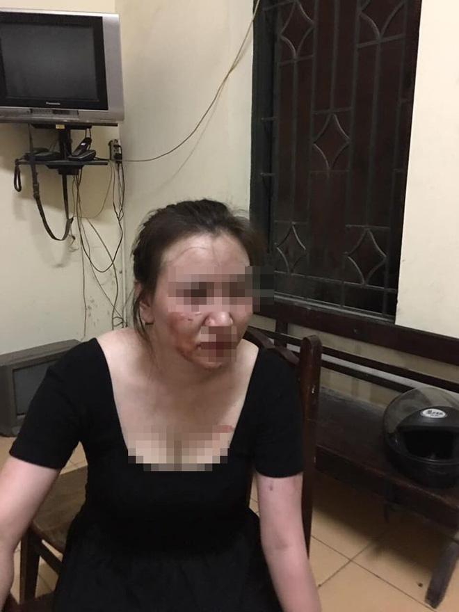 Clip: Chồng liên tục lên gối, đấm đá, cầm dép vả vào mặt vợ rồi dúi ngã xuống cầu thang-2