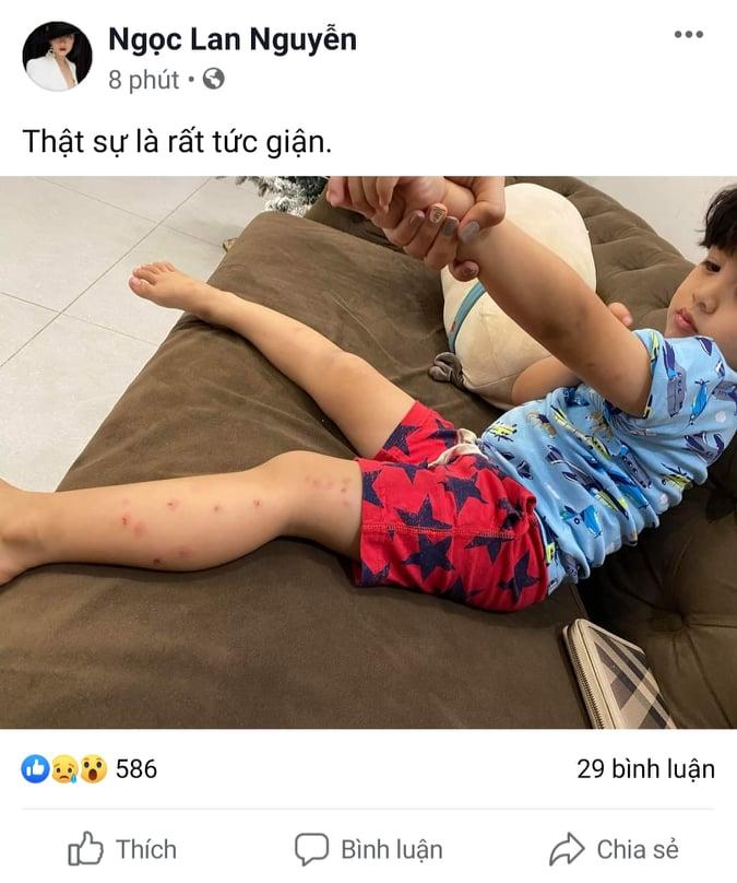 Con trai bị muỗi đốt chằng chịt, Ngọc Lan tức tối nghi vấn Thanh Bình không tận tâm chăm sóc-1