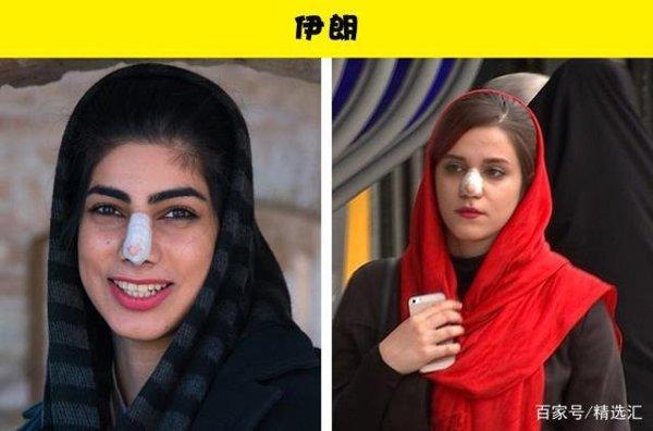 Không phải cứ da trắng, mũi cao là đẹp, đây là tiêu chuẩn sắc đẹp riêng ở các quốc gia-7