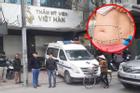 Một cán bộ công an đi hút mỡ bụng tử vong ngay tại thẩm mỹ viện ở Hà Nội