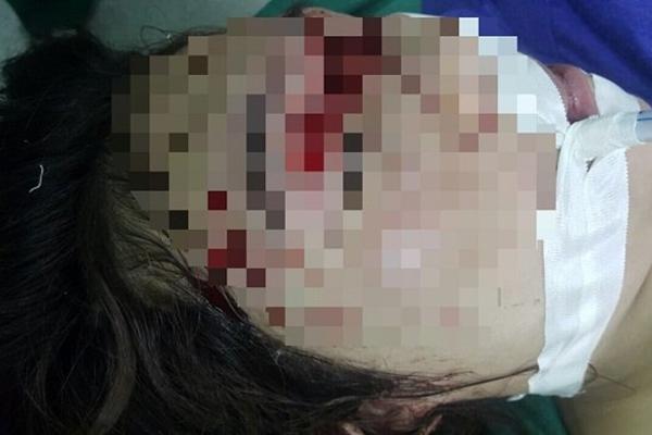 Vụ đầu độc chị họ vì thích anh rể ở Thái Bình: 2 mẹ con cùng uống trà sữa, may mắn trúng 2 cốc... không có độc!-4