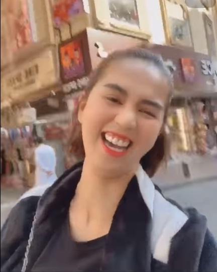 Hết hồn với điệu cười như xé vải của Ngọc Trinh, lại còn lộ rõ khuyết điểm khó phẫu thuật-2