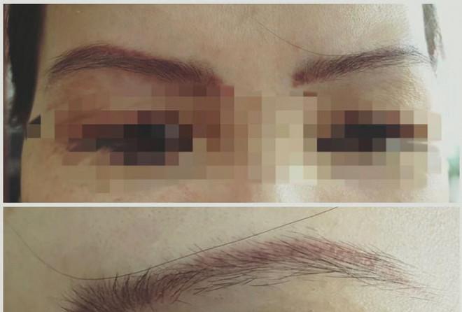 Điểm mặt những tai biến thẩm mỹ rúng động ở Sài Gòn-3