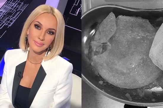 MC người Nga bị rách túi ngực sau 15 năm phẫu thuật