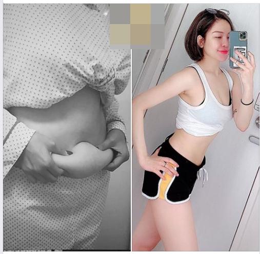 Sau 3 tháng công khai hút mỡ, hotgirl Trâm Anh tung ngay bộ ảnh mặc áo xuyên thấu, đáng chú ý là vòng 2-5