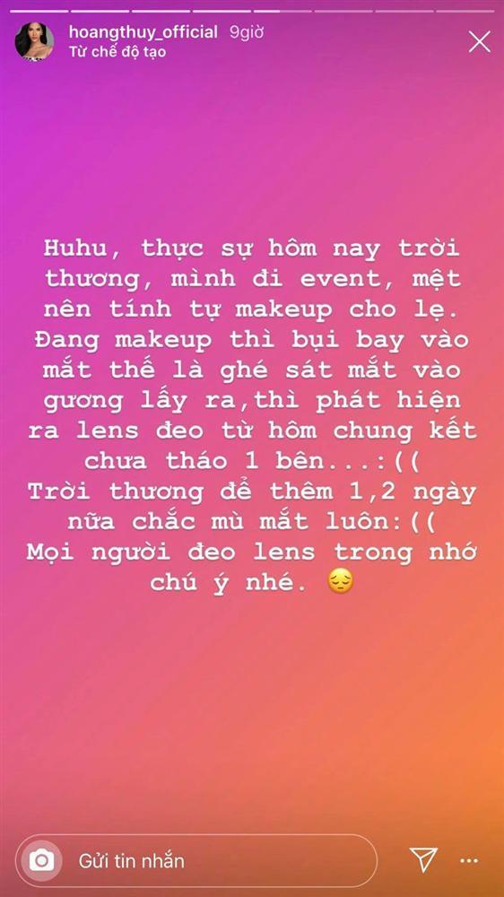 Trau chuốt với đủ kiểu làm đẹp, mỹ nhân làng giải trí khóc ròng vì tự mình hại mình-5