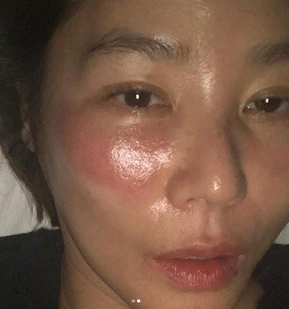 Trau chuốt với đủ kiểu làm đẹp, mỹ nhân làng giải trí khóc ròng vì tự mình hại mình-7