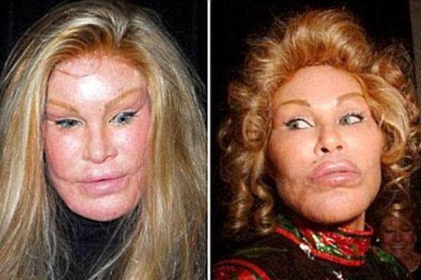 9X Phú Thọ như được hồi sinh sau 3 ca đại phẫu gương mặt-4