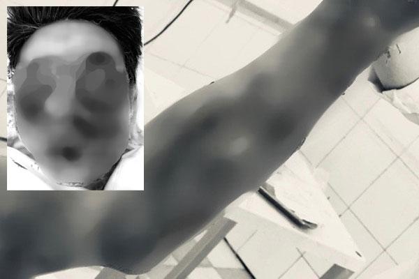 Gia Lai: Làm pháo tự chế bằng bột diêm, nam sinh bị thương nặng-2