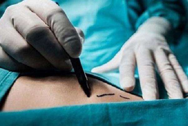 Lật tẩy đường dây mua bán bộ phận cơ thể người và số phận bi đát của những nạn nhân bán thận-2