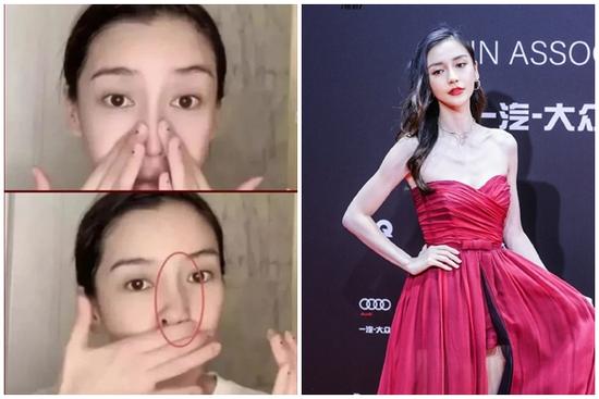 Angelababy bị lộ di chứng thẩm mỹ khi mũi bị vẹo lúc livestream?