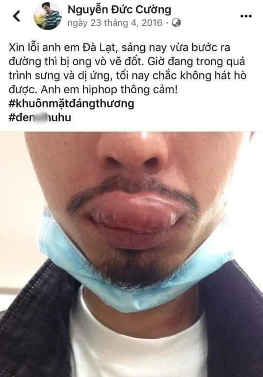 Toang đến nơi rồi Đen Vâu ơi: Bộ sưu tập những hình ảnh dìm hàng thời chưa để râu bị đào mộ không trượt phát nào-11