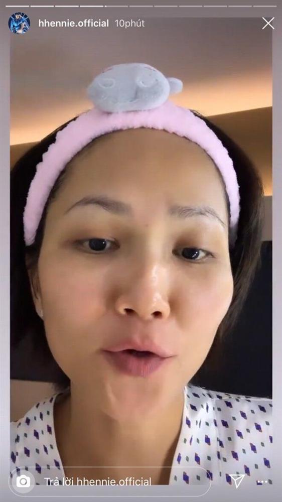 Mặt mộc đẹp không tì vết, nhưng mỹ nhân Việt vẫn mất điểm vì đôi mắt thâm đen-2