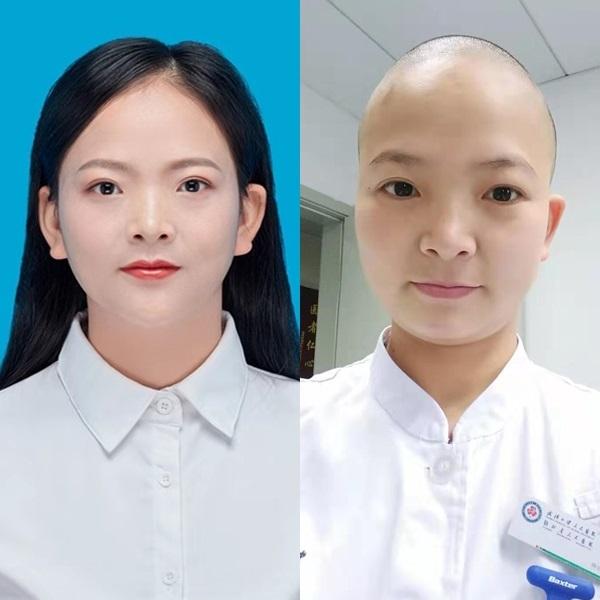 Nữ y tá ở tâm bão Vũ Hán cạo trọc đầu để tránh lây nhiễm chéo virus corona-1