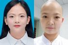 Nữ y tá ở 'tâm bão' Vũ Hán cạo trọc đầu để tránh lây nhiễm chéo virus corona