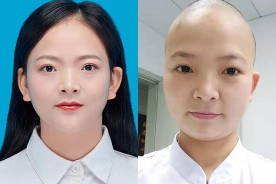 Nữ y tá ở 'tâm bão' Vũ Hán cạo trọc đầu để tránh lây nhiễm chéo virus corona