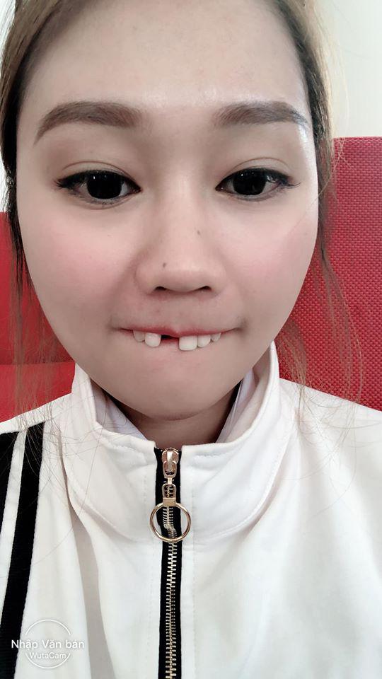 Cô gái đeo khẩu trang xuyên Tết đến tận lúc đi làm, nguyên nhân thực sự khiến nhiều người giật mình-3