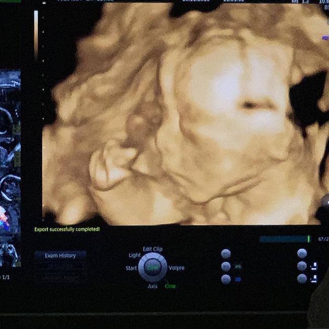 Bầu bí sắp đến kì sinh nở, ái nữ nhà Minh Nhựa lần đầu khoe ảnh siêu âm con trai-1