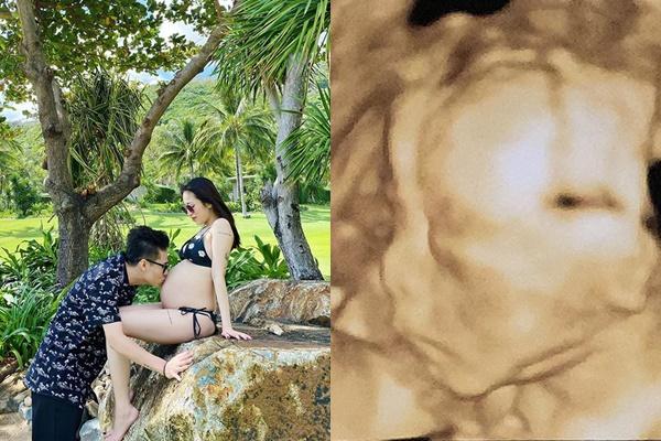 Khoe chuẩn bị cả vali đồ sơ sinh, em gái Trấn Thành để lộ giới tính con đầu lòng với chồng ngoại quốc-3