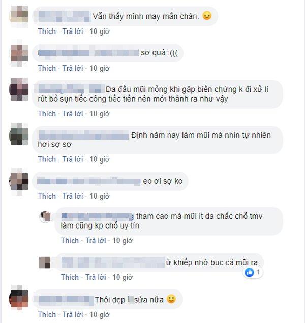 Cô gái bị bục da mũi, lộ hết sụn độn hậu nâng mũi: Đâu là bài học cho chị em?-5