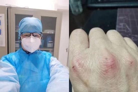 Bác sĩ ở Vũ Hán khám 300 bệnh nhân/ngày, tay trầy xước vì chất tẩy rửa