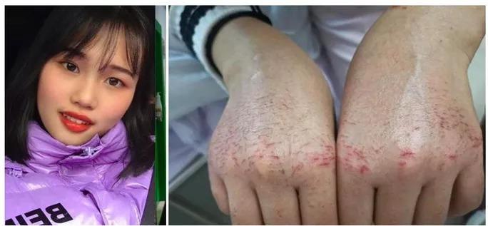 Bác sĩ 28 tuổi đột tử sau 10 ngày đối phó virus corona-3